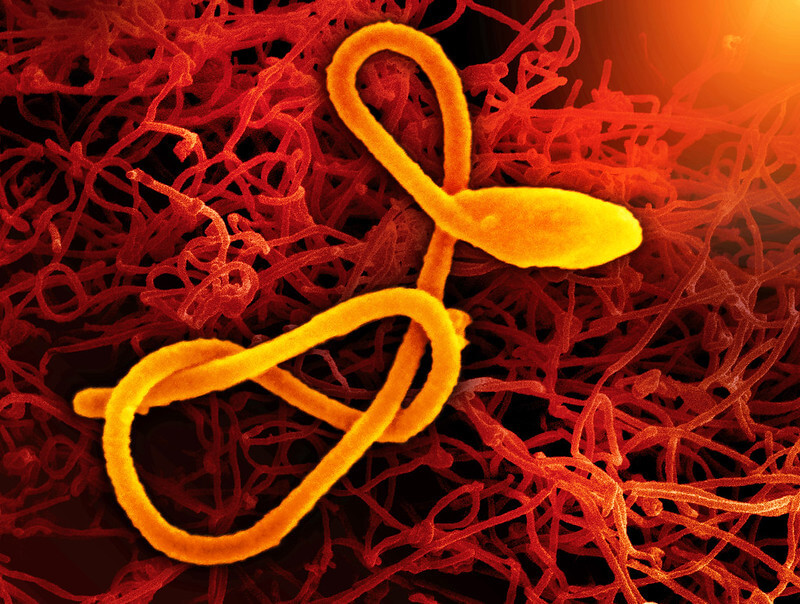 Representación del virus del ébola